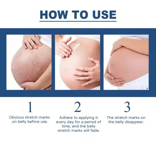 EELHOE স্কার রিমুভ জেল – সার্জারি, ব্রণ ও পোড়া দাগ দূর করার কার্যকরী সমাধান 💯